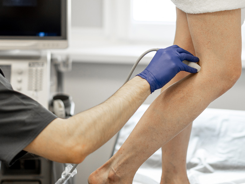 Varicose Vein Solutions